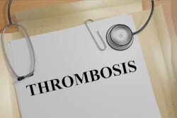 thrombosis