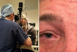 todd-dewey-eye