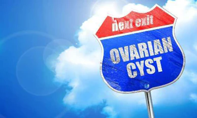 Pcos