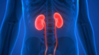 X-ray picture of kidneys