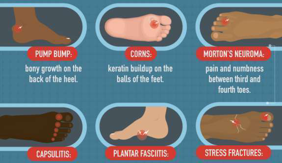 Care for your feet infographic