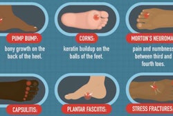 Care for your feet infographic