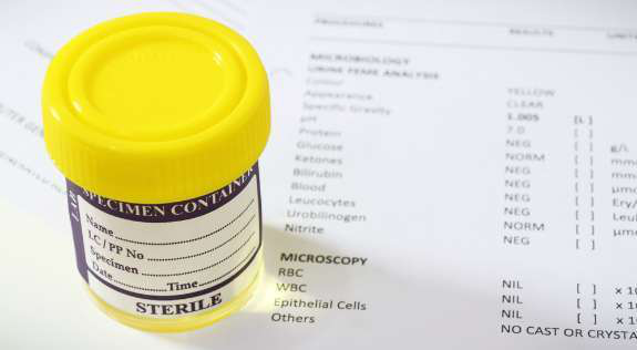 drug-test