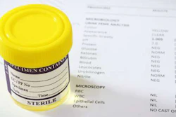 drug-test