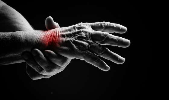 hand-arthritis