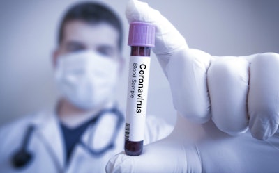 coronavirus